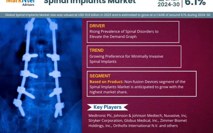 Spinal Implants Market Trends: Size, Share, and Future Outlook 2024-2030