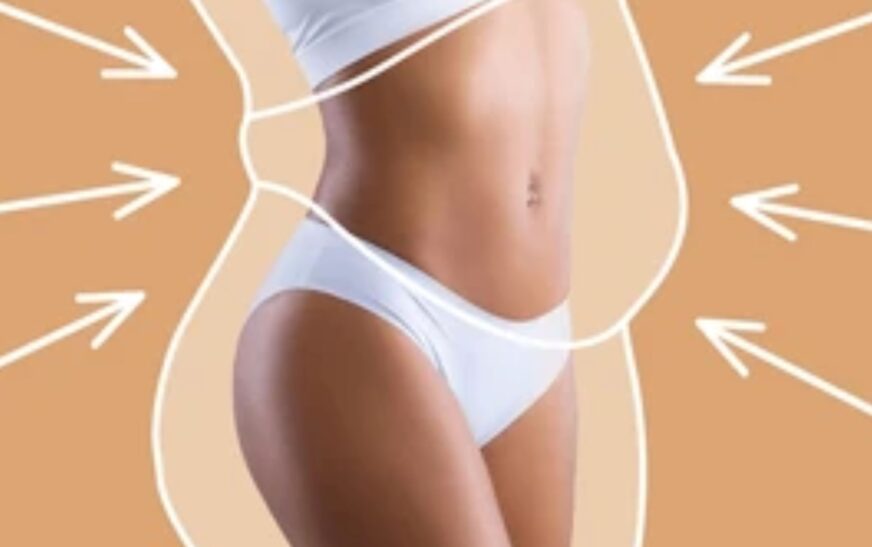 Liposuction Abdomen 360 in Maryland