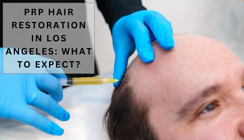 PRP Hair Restoration in Los Angeles: What to Expect?