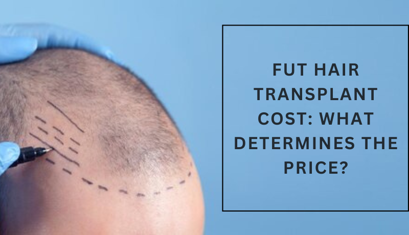 How to Address the Issue of Hair Loss and Partial Baldness?