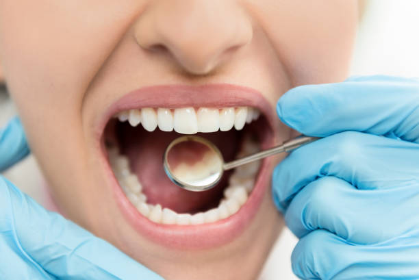 Unlock Your Best Smile with Sedation Dentistry in Fort Worth, TX