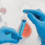 lipid profile test