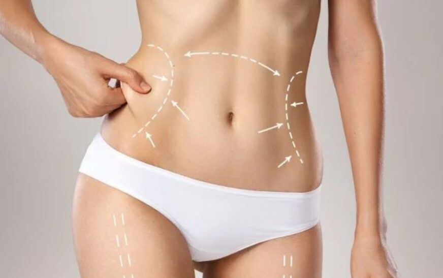 Top Reasons to Choose Body Contouring in Dubai