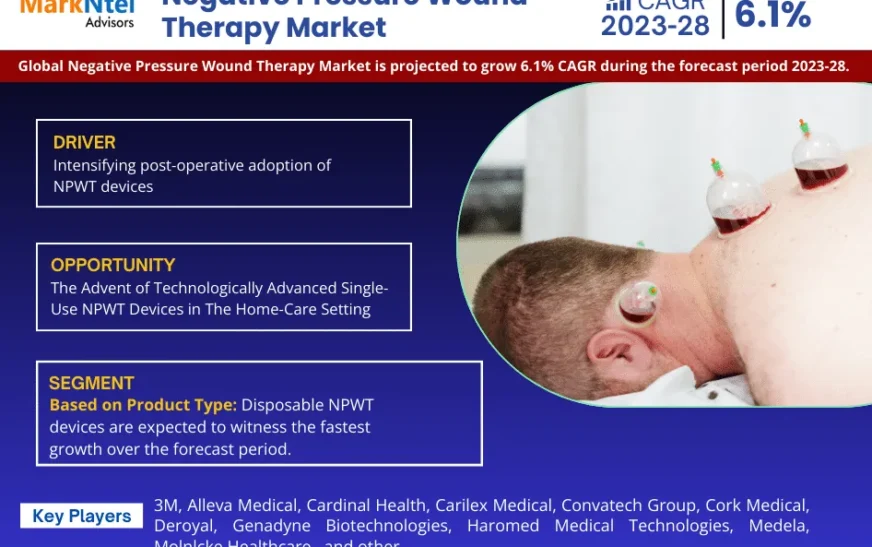 Negative Pressure Wound Therapy Market Size, Share, Trends, Demand, Growth and Competitive Analysis 2028