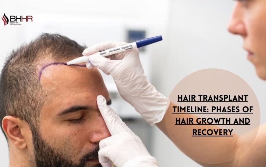 Hair Transplant Timeline: Phases of Hair Growth and Recovery