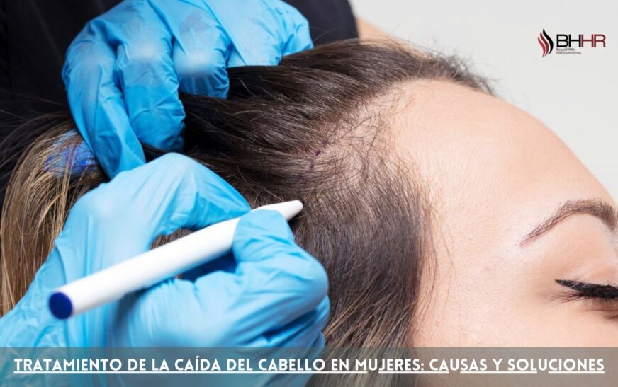 Tratamiento de la caída del cabello en mujeres: causas y soluciones