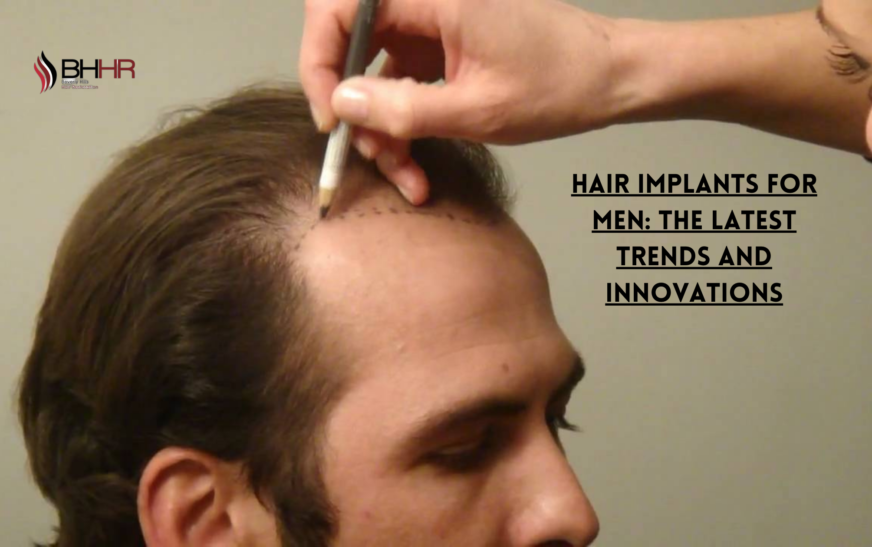 Hair Implants for Men: The Latest Trends and Innovations