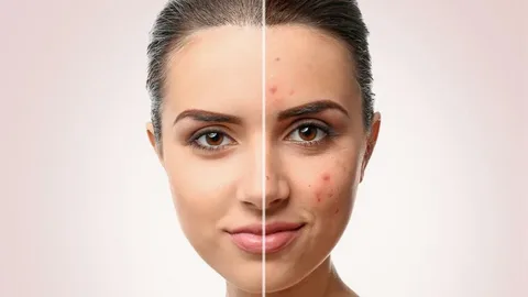 How Proper Face Care Can Help Prevent Acne Breakouts