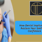 Dental Implants